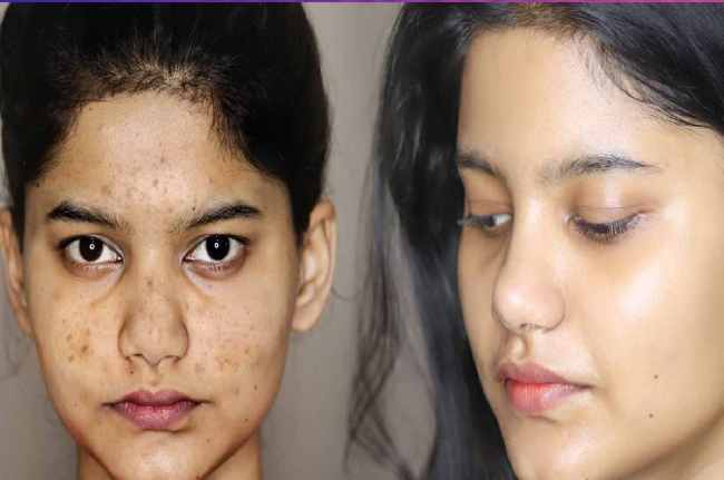 Skin care TIPS How to Get glowing skin with sleep