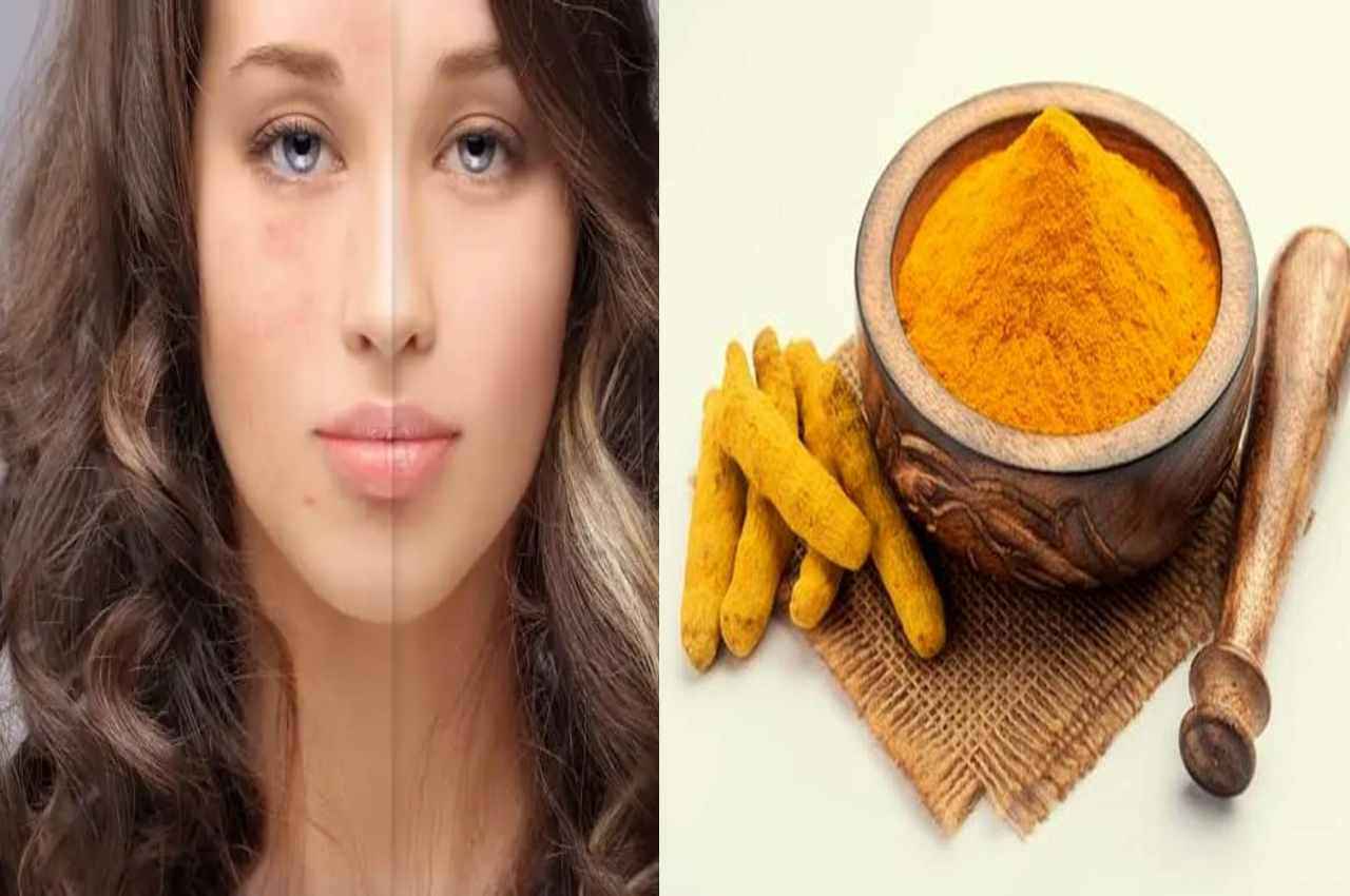 Glowing SKIN: रात में चेहरे पर इस चीज में मिलाकर लगाएं 2 चम्मच हल्दी....सुबह मिलेगा जबरदस्त निखार