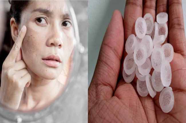 Pigmentation treatment at home with Camphor