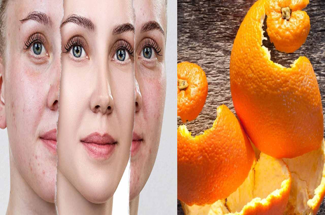 Skin care TIPS Orange face pack is cure for many problems