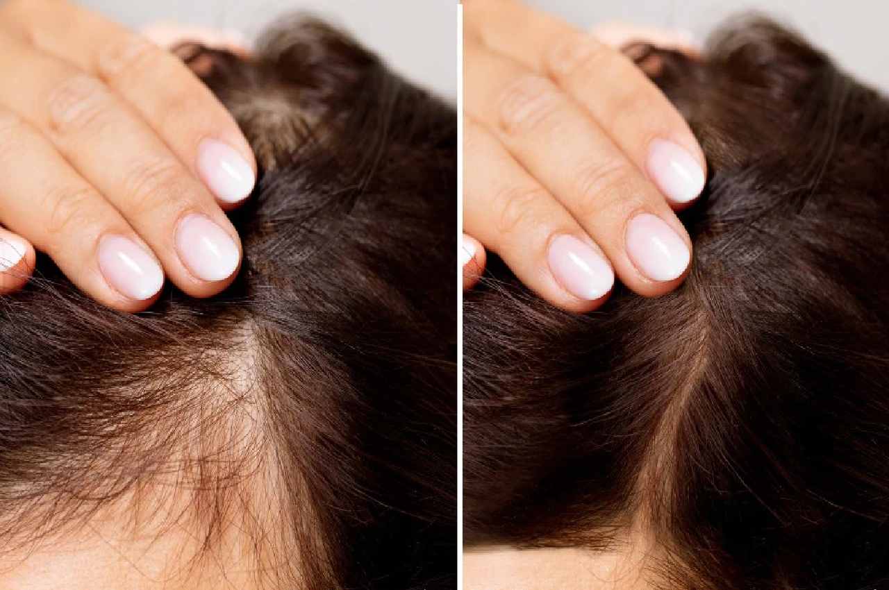 Hair growth in hindi Aloe vera and coconut oil