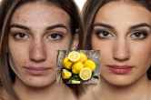 Skin care TIPS Benefits of applying lemon on face