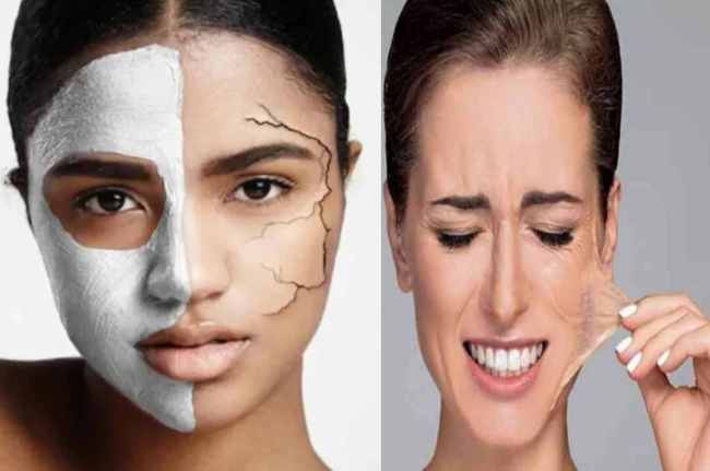 Dead Skin Remove Homemade Scrub for dead skin