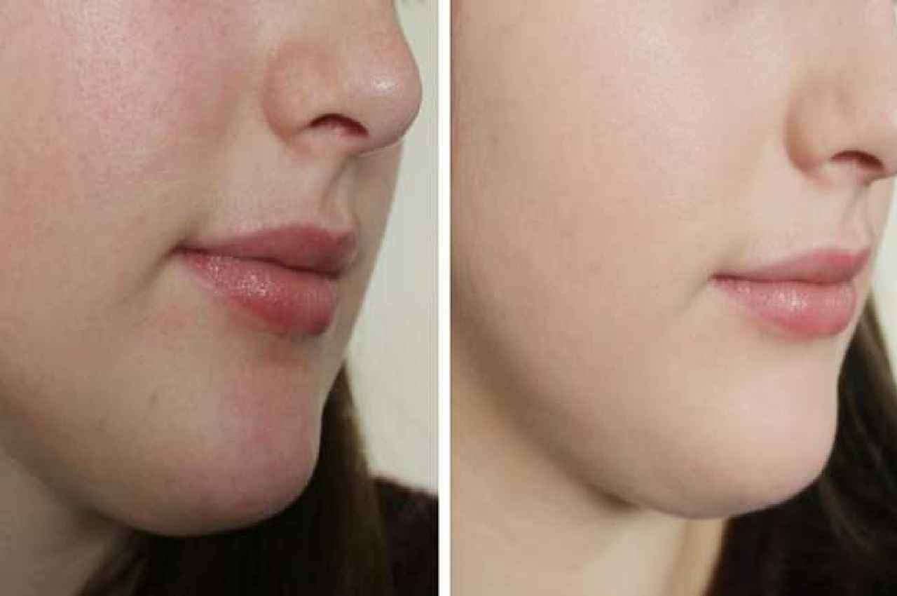 Night skin CARE: ये 3 नुस्खे बदल देंगे चेहरे की रंगत, रात में लगाएं, सुबह मनचाहा निखार पाएं