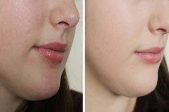 Night skin CARE night skin care routine Gora hone ka tarika