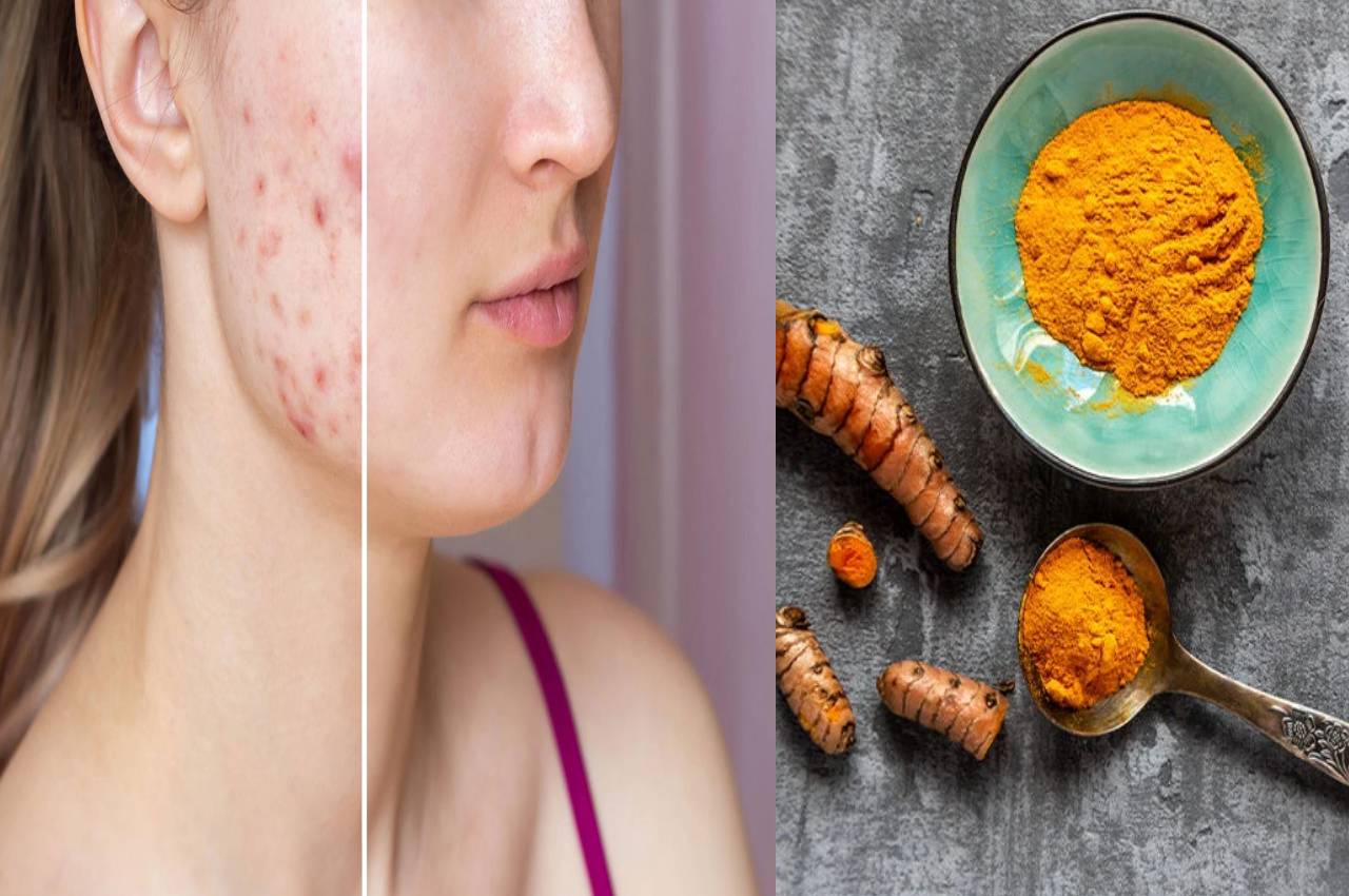 Skin care routine benefits of turmeric for skin acne treatment
