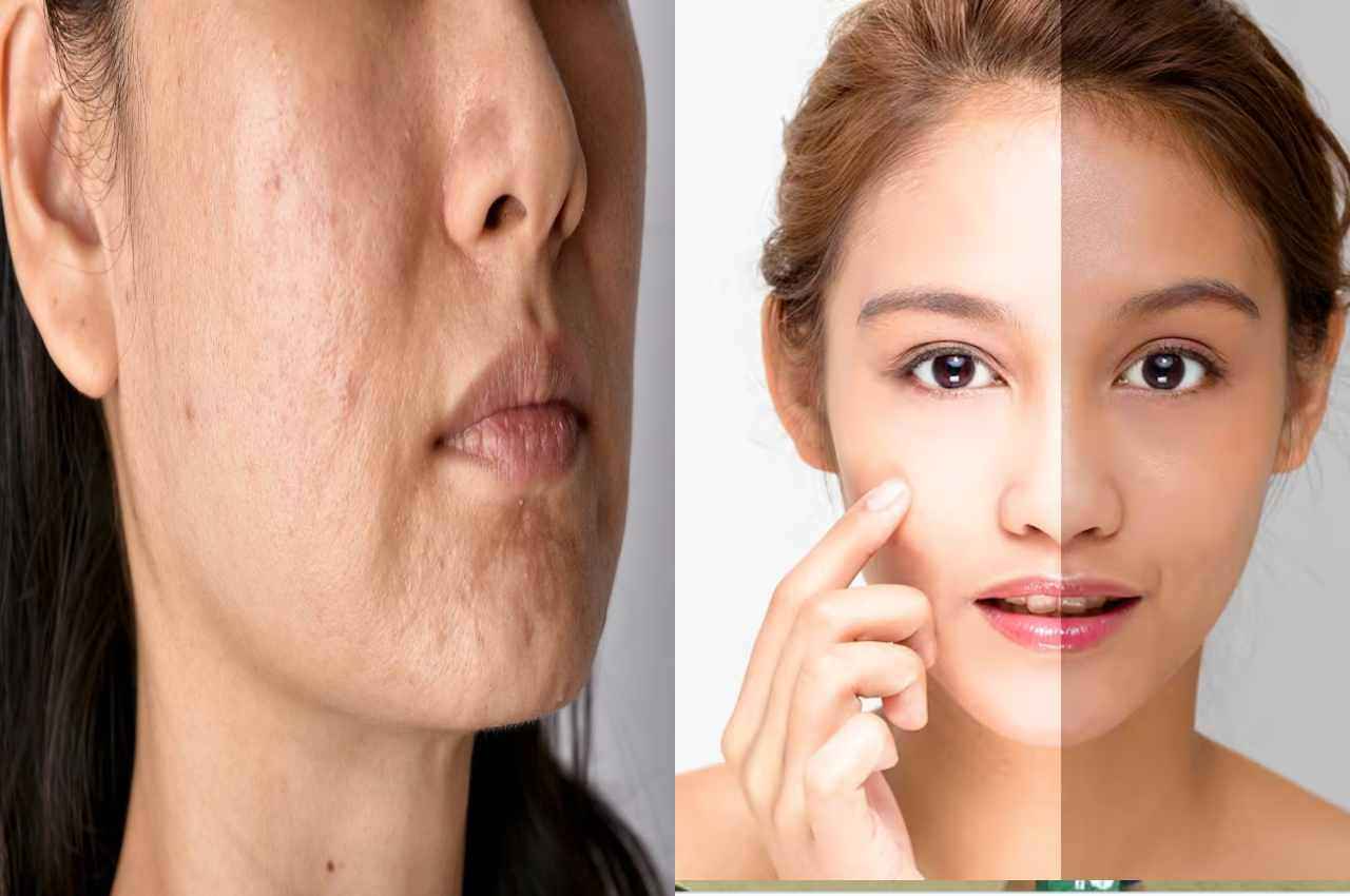Skin Care TIPS: रात में Face पर लगाएं ये तेल...1 महीने बाद मिल जाएगा मचचाहा निखार...दाग-धब्बे, पिंपल सब होंगे छूमंतर