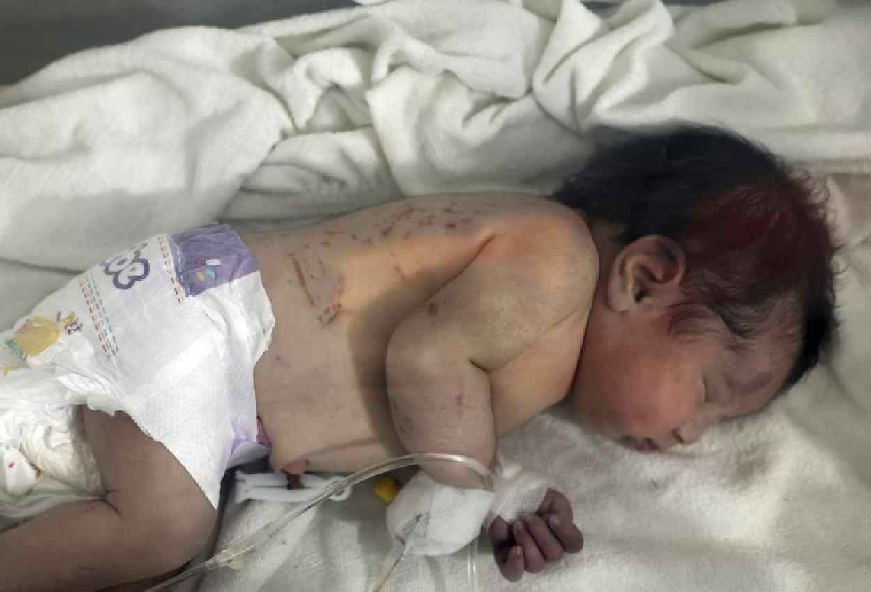 Turkey Syria Earthquake: चमत्कार... मलबे में गूंजी किलकारी, 10 घंटे बाद नवजात को सुरक्षित निकाला