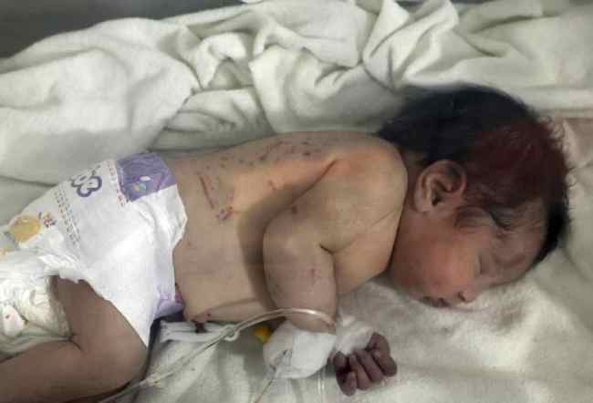 Delhi News, Newborn, LNJP, Delhi Crime News, Mustafabad