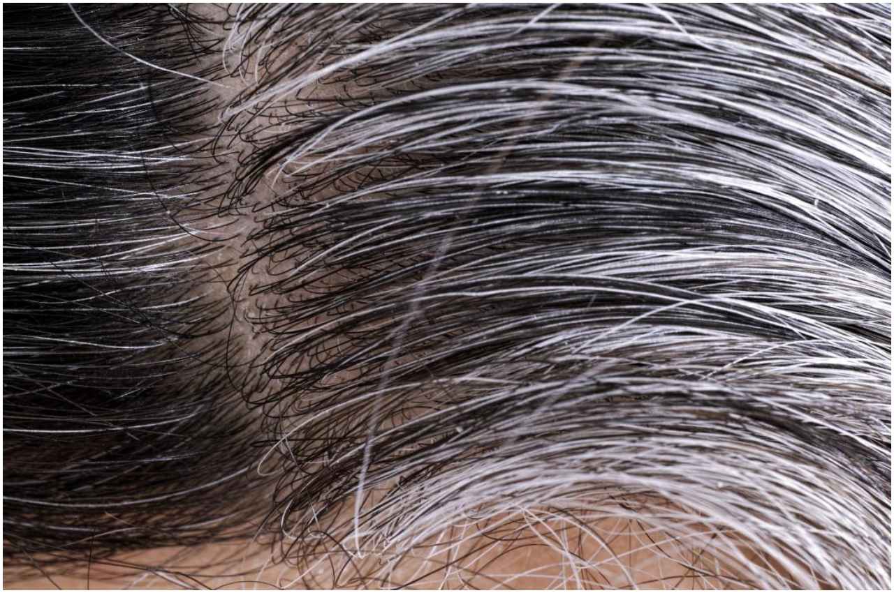 White Hair Problem