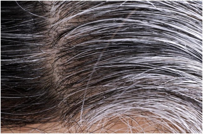 White Hair Problem White Hair Problem