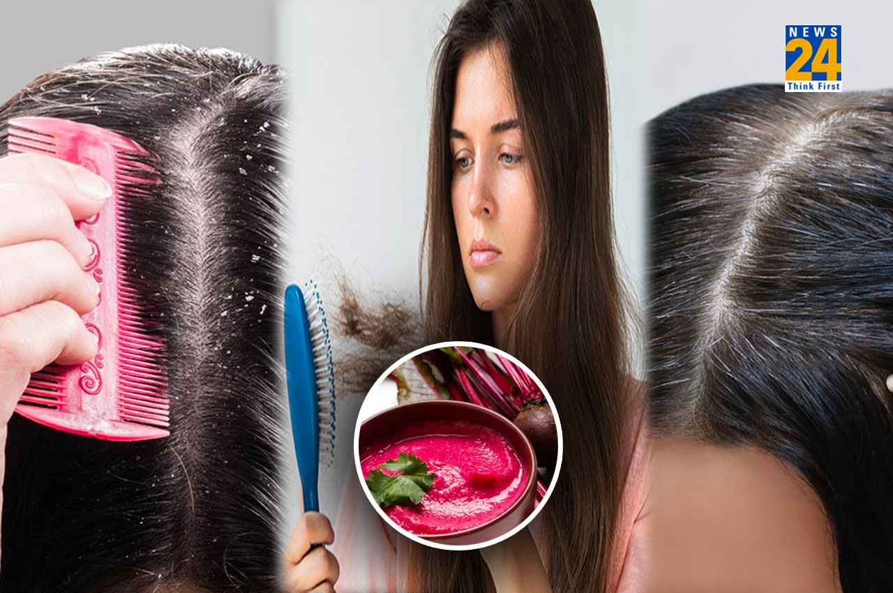 Beetroot Peel Hair Mask: डैंड्रफ और बालों का झड़ना ही नहीं, सफेद बाल होने से भी रोकता है ये हेयर मास्क