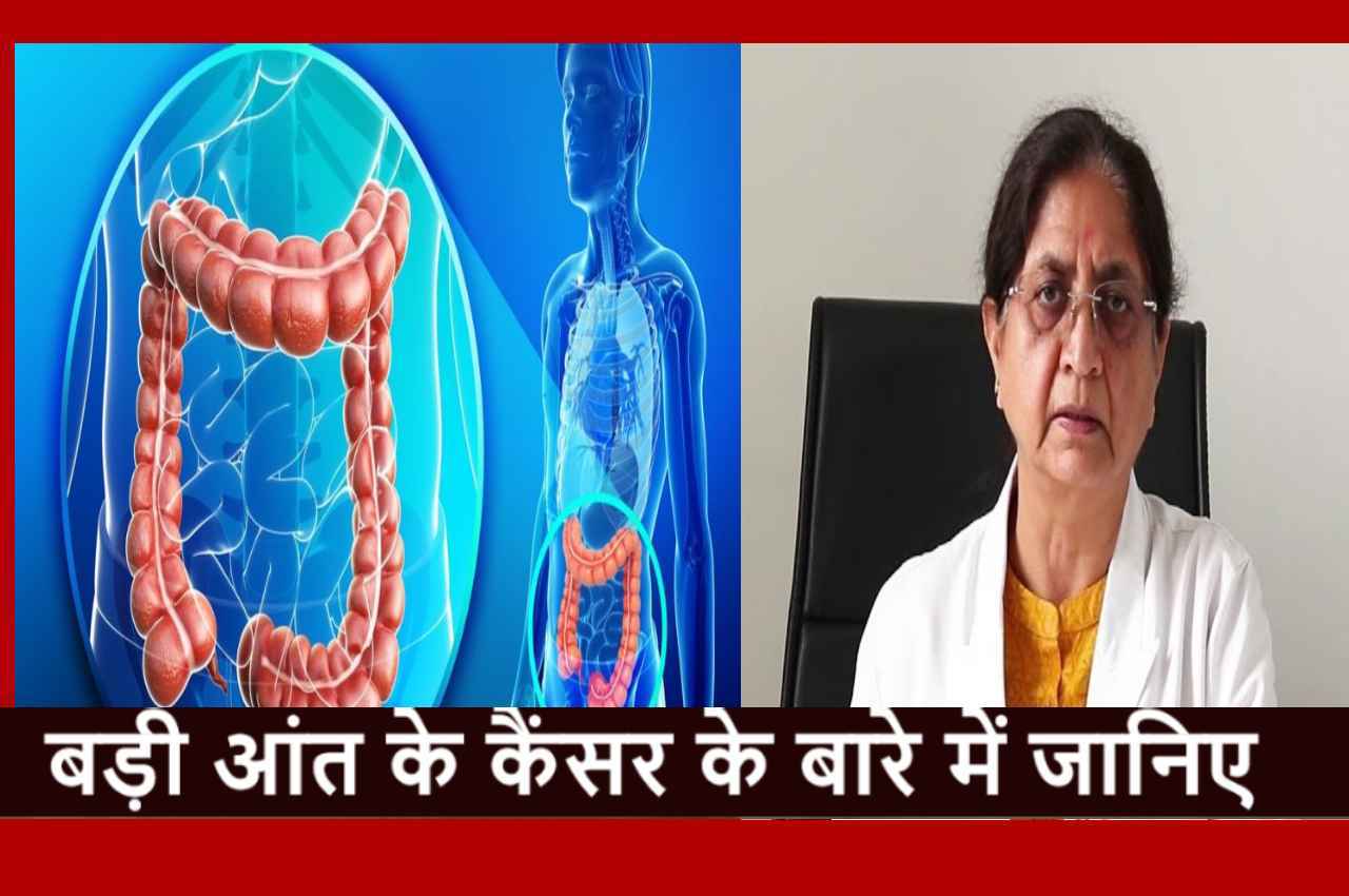 Colorectal cancer: बेहद खतरनाक है बड़ी आंत का कैंसर, Dr. Tejinder Kataria से जानिए इसके बारे में सबकुछ