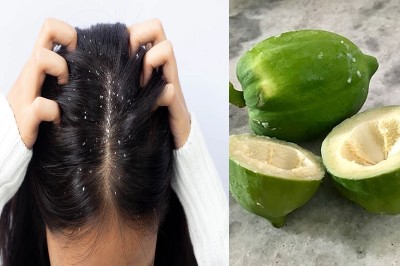Dandruff Removal TIPS Raw papaya is beneficial for hair