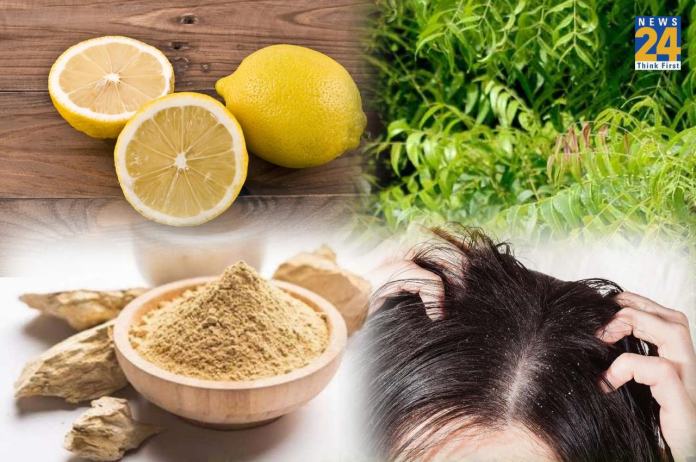Home Remedies For Dundruff