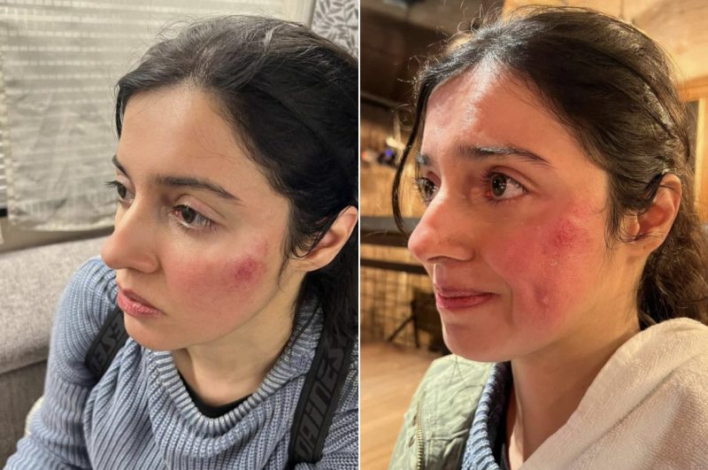 Divya Khosla Kumar Injured