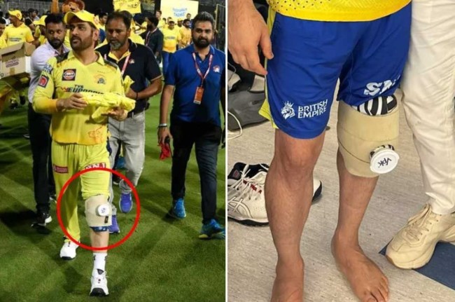 MS Dhoni Injury