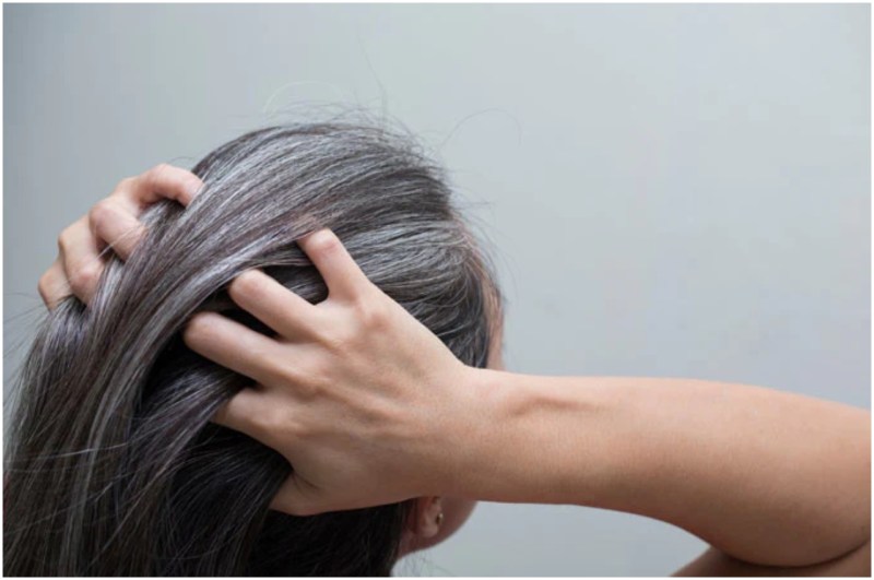 White Hair Home Remedies