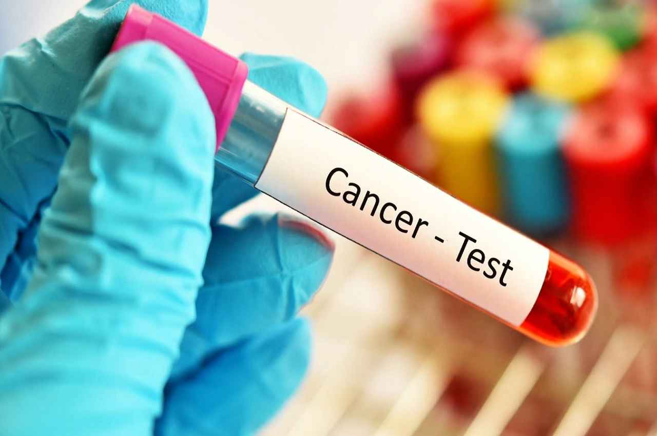 Galleri Blood Test