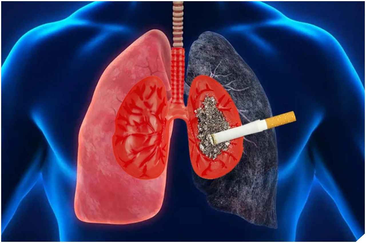 World No Tobacco Day: तंबाकू का सेवन करने वाले हो जाएं सावधान, इसकी लत 1 दर्जन कैंसर का शिकार बना सकती है,डॉक्टर ने बताए नाम