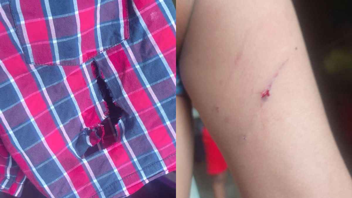 हाई सिक्योरिटी गेटेड सोसायटी में स्ट्रीट डॉग्स का आतंक, मासूम पर हमला कर नोंचा