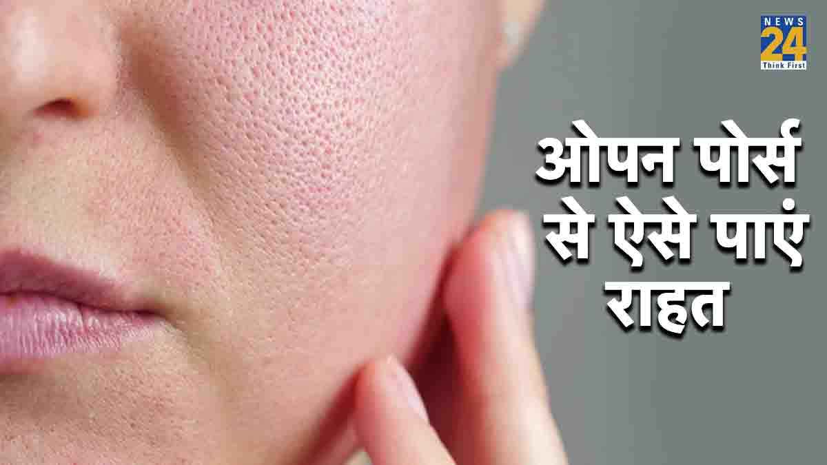 Skin Care Tips: ओपन पोर्स की समस्या से छुटकारा पाने के 4 घरेलू उपाय