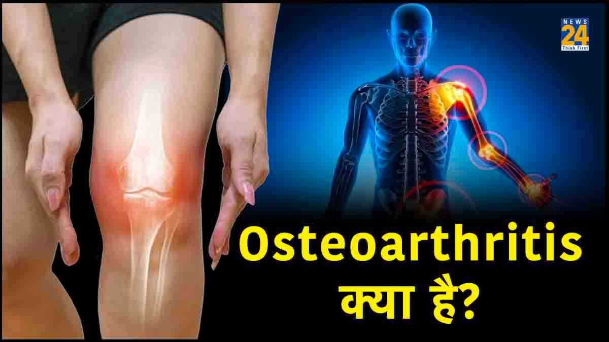 तेजी से बढ़ रही Osteoarthritis की बीमारी, जानें महिलाएं और पुरुषों में किसको कर रही प्रभावित!