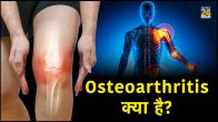 arthritis treatment,rheumatoid arthritis,what are the 7 types of arthritis,is arthritis curable,arthritis definition,arthritis causes,arthritis types,causes of arthritis in hands