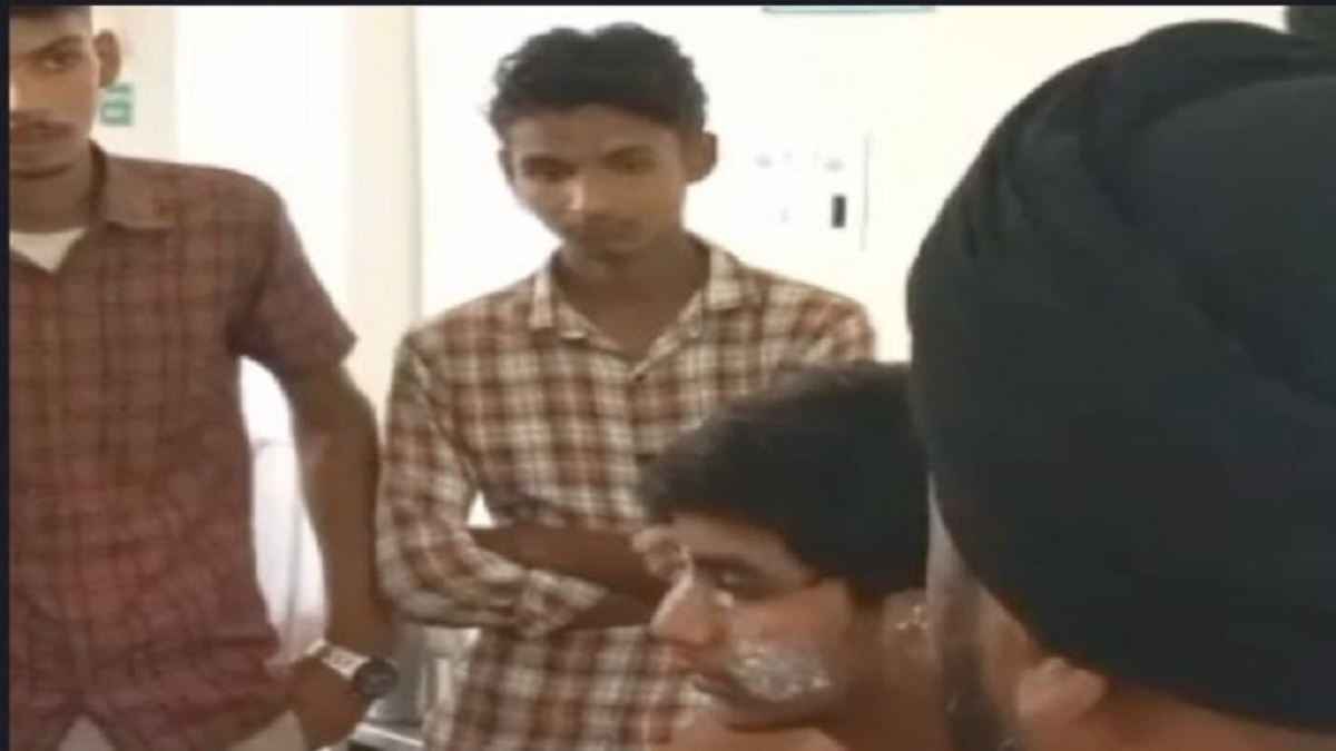 जालंधर के स्कूल में एसिड का शिकार हुए दो छात्र, लैब का समान उठवा रहे थे टीचर, बोतल में अचानक धमाका