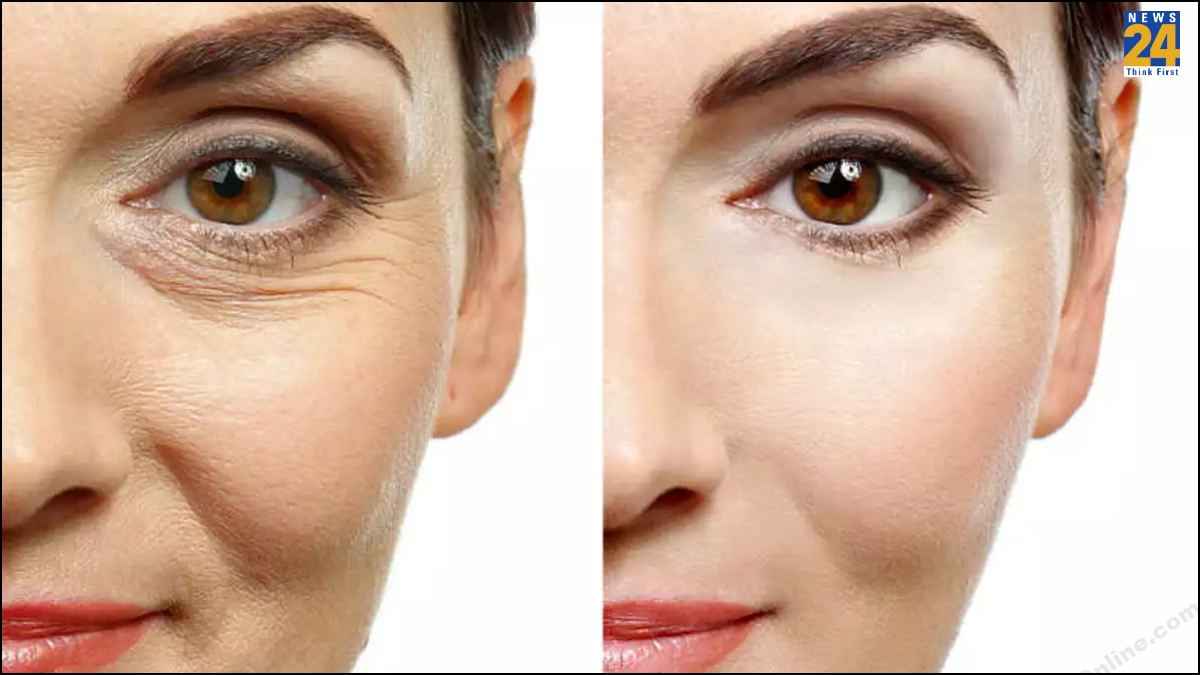 Wrinkles Remove Tips: झुर्रियों से पाना चाहते हैं छुटकारा? अपनाएं ये 5 घरेलू नुस्खा