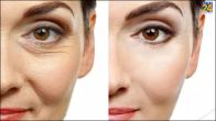 wrinkles, wrinkles home remedies, Skin Care, Skin Care Tips in hindi, wrinkles remove tips