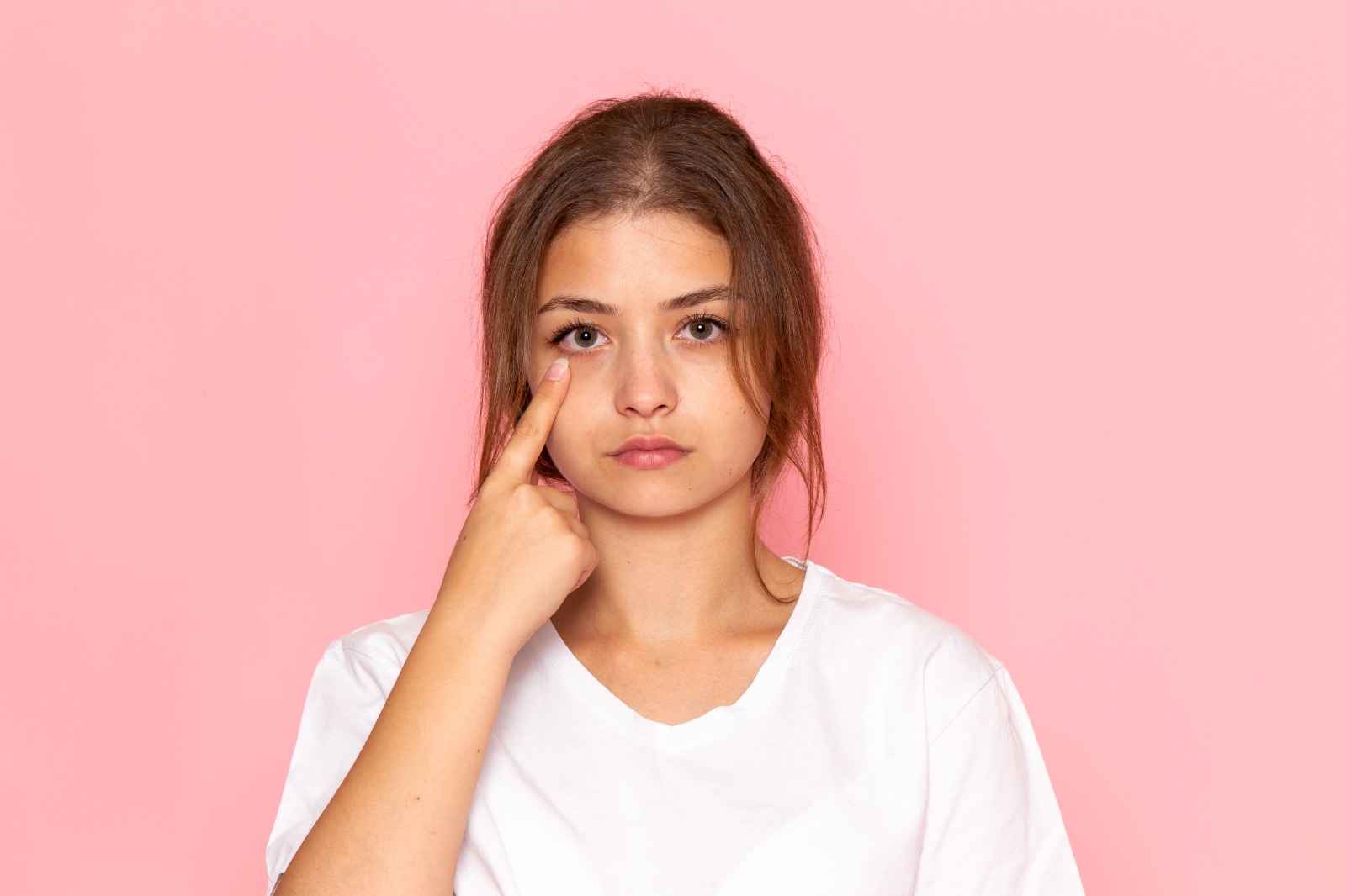 Dark Circles Under The Eyes