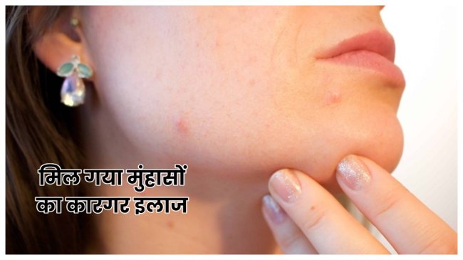 Health News, Health News in hindi, science news, science news in hindi, birth control pills