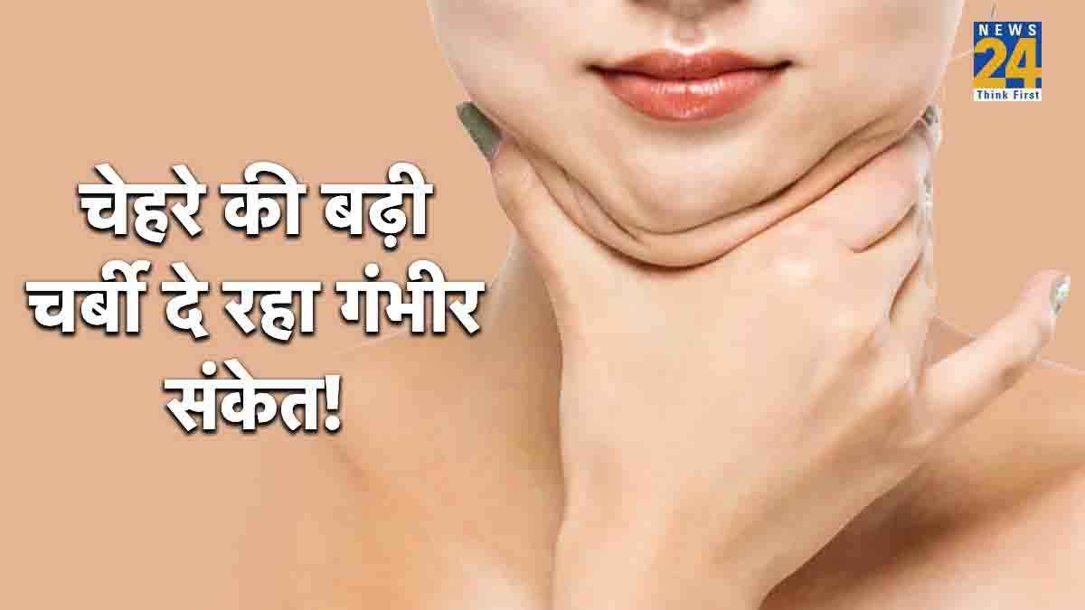 facial lipoatrophy,facial lipoatrophy treatment,facial lipoatrophy causes,facial lipoatrophy symptoms,lipodystrophy,facial lipoatrophy hiv,what causes fat atrophy, face fat reduction treatment,buccal fat removal surgery