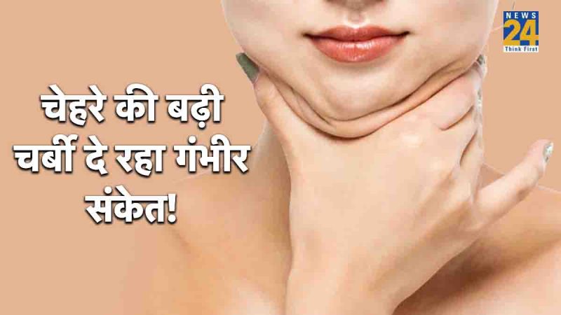 facial lipoatrophy,facial lipoatrophy treatment,facial lipoatrophy causes,facial lipoatrophy symptoms,lipodystrophy,facial lipoatrophy hiv,what causes fat atrophy, face fat reduction treatment,buccal fat removal surgery