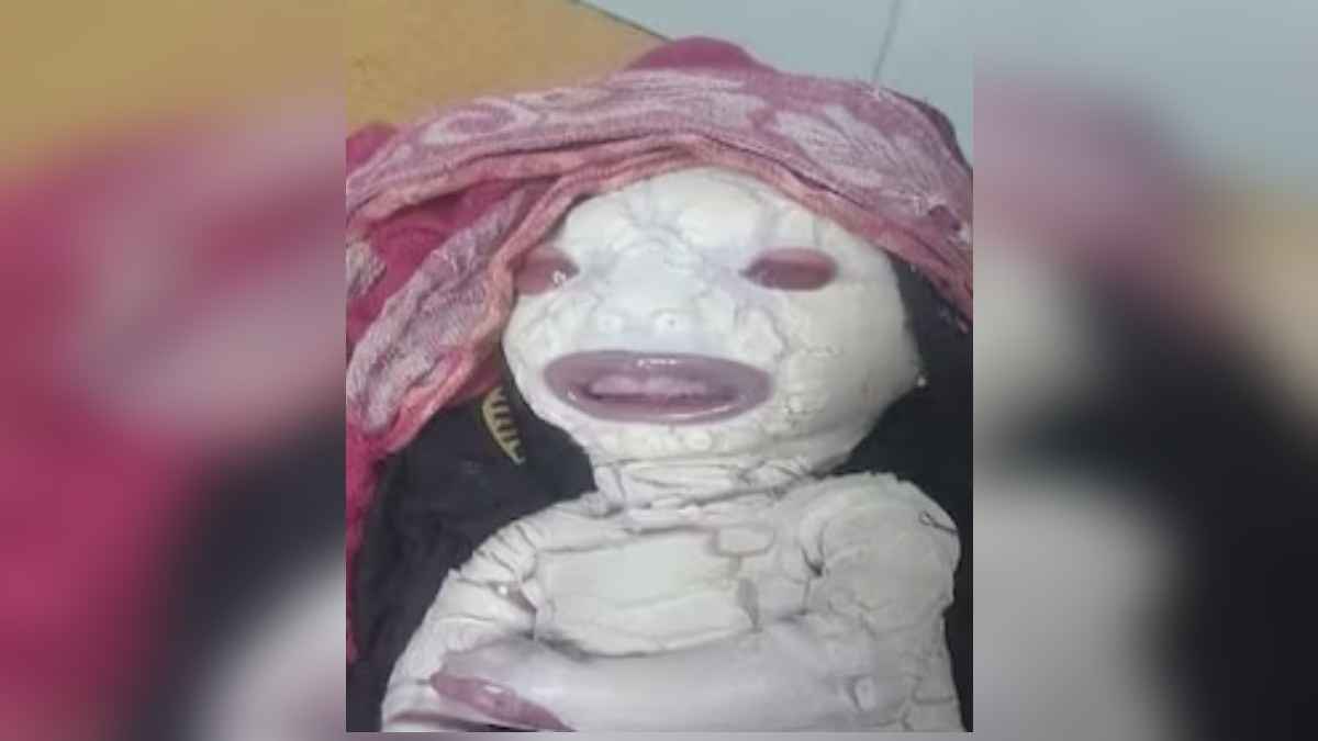 यूपी में पैदा हुआ एलियन जैसा बच्चा! डिलिवरी के बाद डॉक्टर हैरान और मां परेशान
