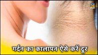 neck cure, Aloe vera gel for dark neck, Baking soda for dark neck, Potato juice for dark neck, cucumber