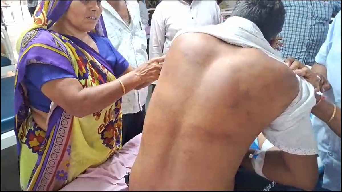 कंस्ट्रक्शन साइट पर था दलित इंजीनियर, डीजल चोरी के आरोप में लोगों ने बेहरमी से पीटा