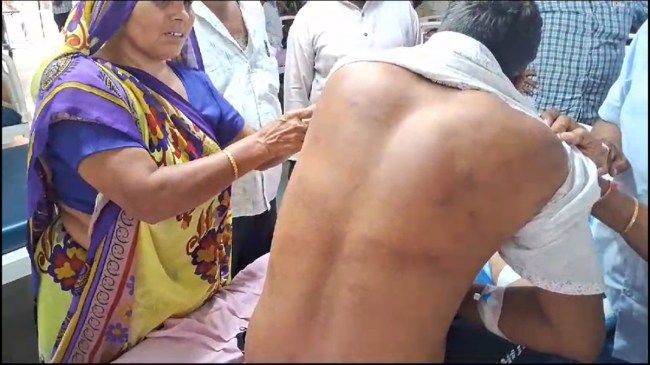 कंस्ट्रक्शन साइट पर था दलित इंजीनियर, डीजल चोरी के आरोप में लोगों ने बेहरमी से पीटा