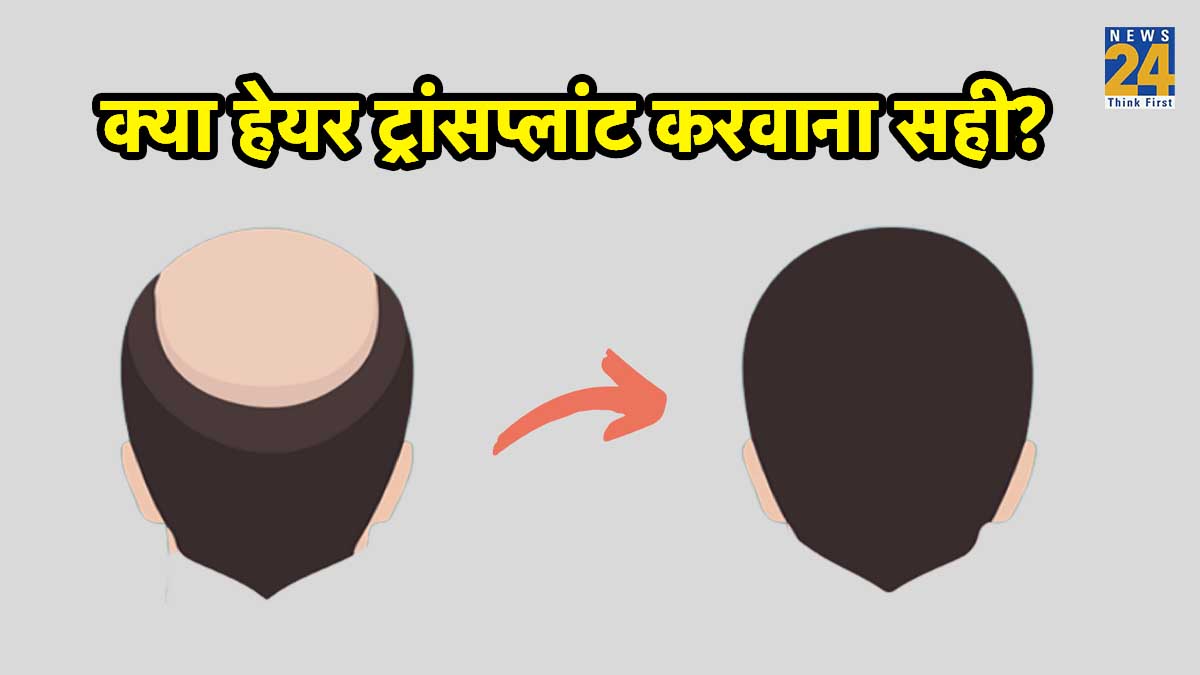 Hair transplantation process, important Facts about hair transplant, Hair transplantation painful, hair transplant side effects