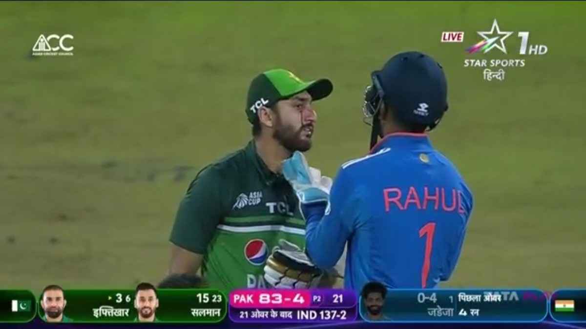IND vs PAK Salman Ali Agha Eye Injured on Ravindra Jadeja ball