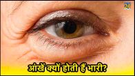 how to treat a swollen eye,what is the fastest way to heal a swollen eyelid?,why is my upper eyelid swollen,one eye swollen in the morning,under-eye swelling,eyelid swelling causes,how to treat swollen eyes from allergies,swollen upper eyelid treatment