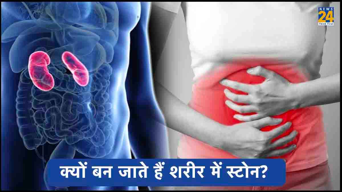 रोजमर्रा की इन चीजों से भी होती है पथरी, क्या आपको भी दिखें ये लक्षण