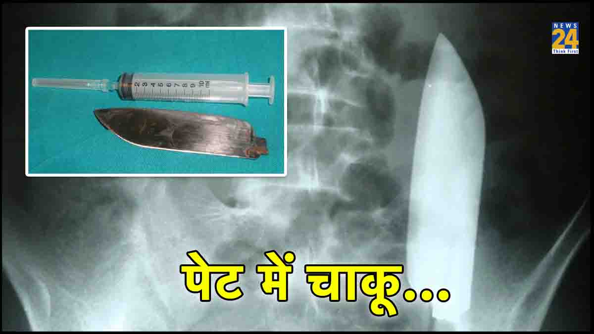 Nepal News, Knife Found In Abdomen, Nepal Medical Institution