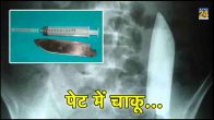 Nepal News, Knife Found In Abdomen, Nepal Medical Institution