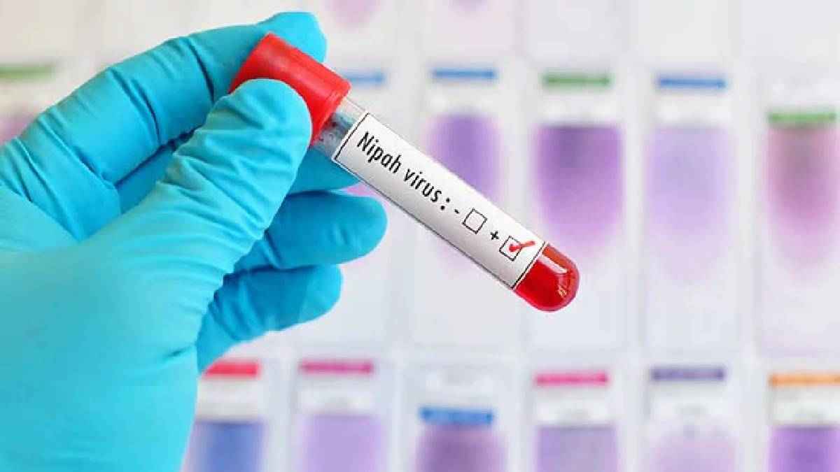 केरल में निपाह का कहर; 7 गांवों को कंटेनमेंट जोन बनाया, जानें कितना खतरनाक है ये VIRUS?