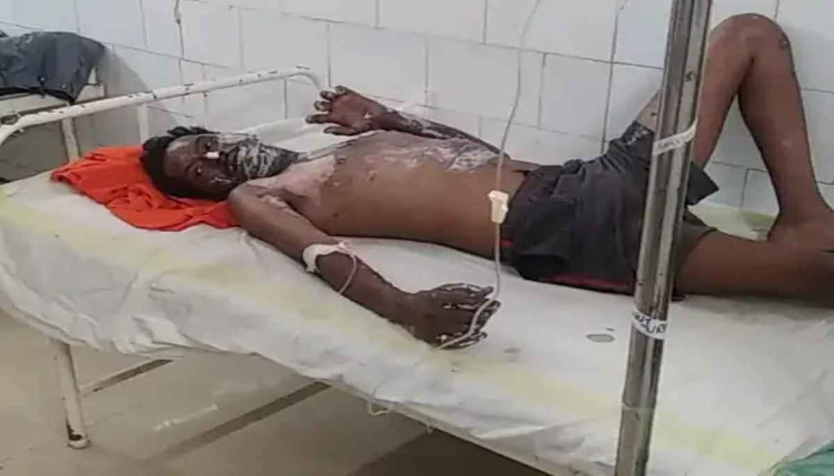 दारु के लिए पति ने मांगे 100 रुपए तो पत्नी ने पेट्रोल छिड़क कर लगा दी आग, जानें पूरा मामला