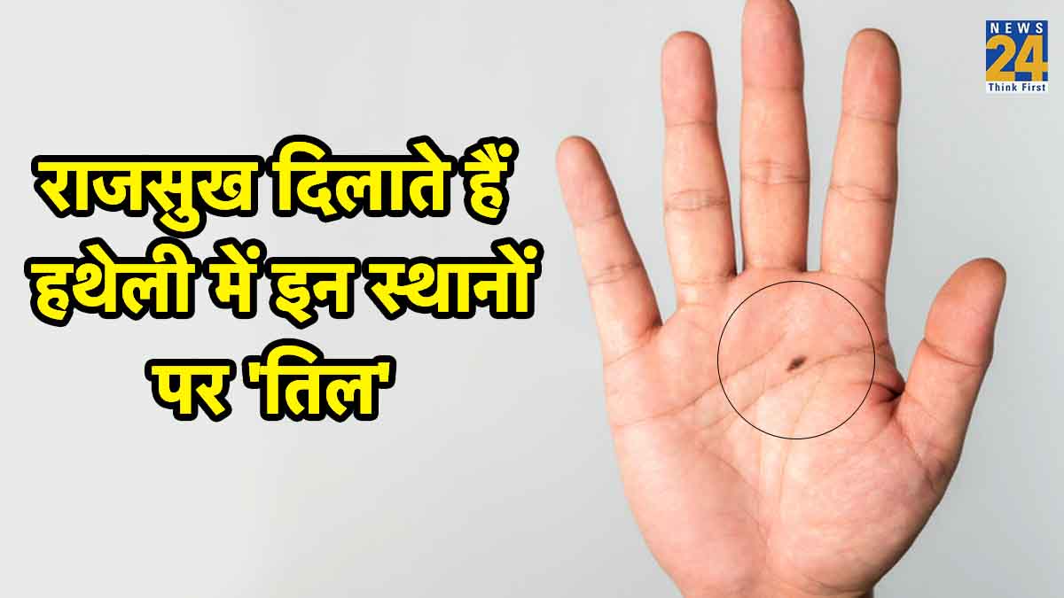 Palmistry Mole Sign