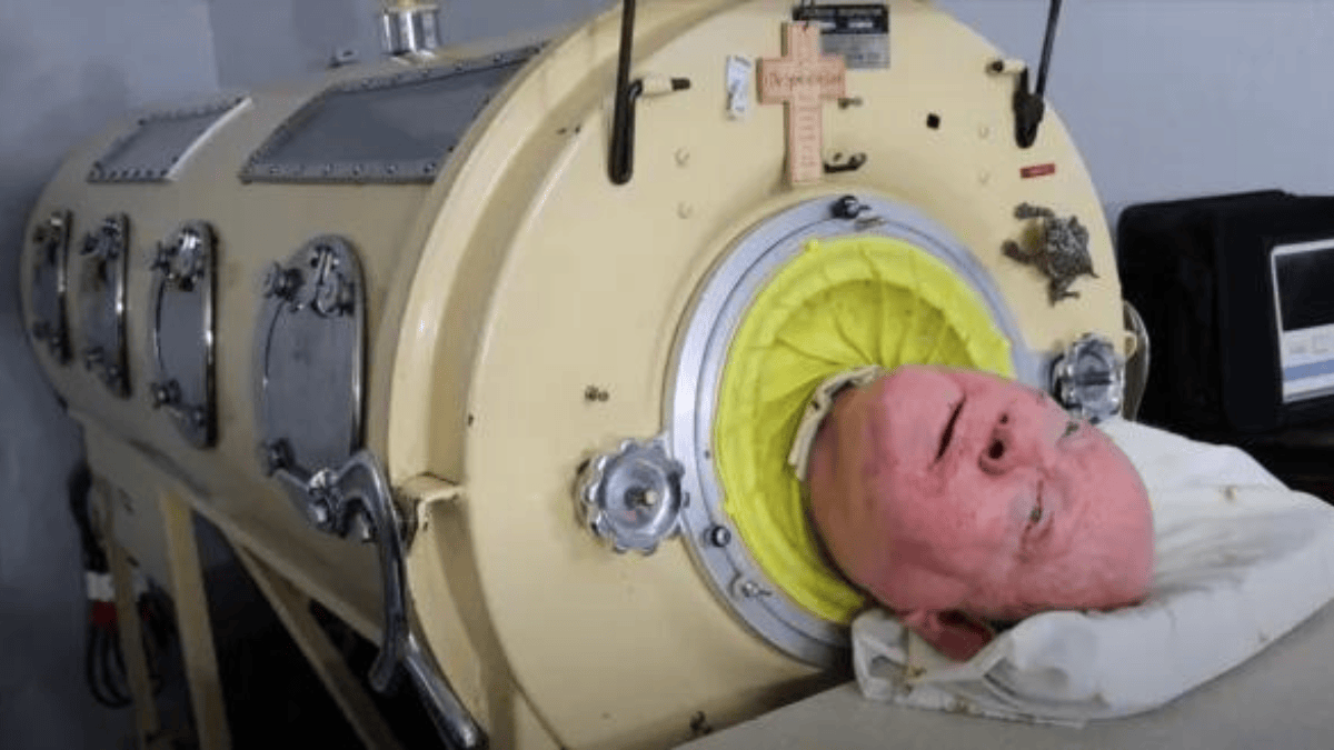 Guinness World Record, Paul Alexander, Polio, Iron lung,