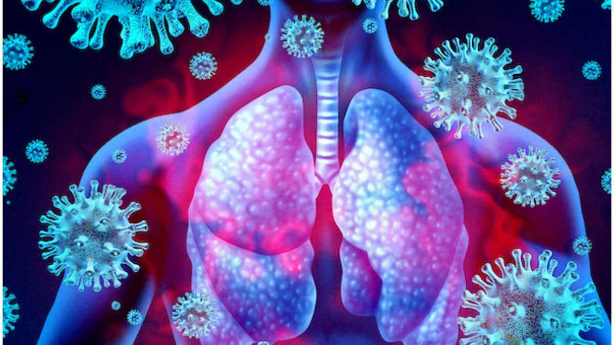 Mystery Respiratory Virus,new virus in hyderabad today,h3n2 virus symptoms,Mystery Respiratory Virus Evades Testing